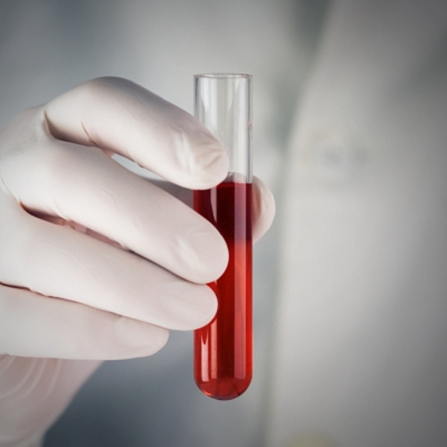 <p>Baltijas valstis sadarbosies asins un medicīnisko resursu nodro&scaron;inājumā ārkārtas situāciju gadījumos</p>